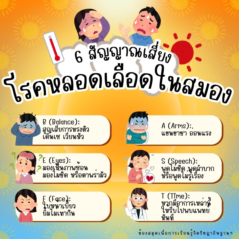 โรคหลอดเลือดสมอง